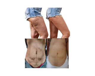 2 weeks Flat Tummy Tea