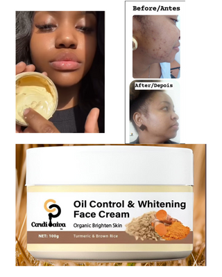 Oil Control & Whitening Face Cream