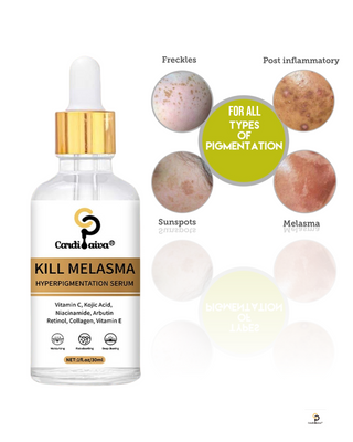 Kill Melasma Hyperpigmentation Face Serum
